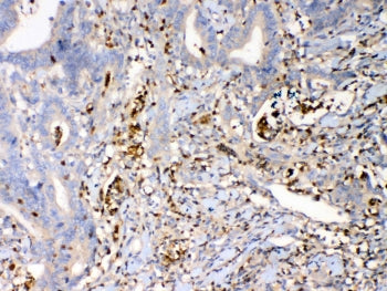 S100A7 Antibody / Psoriasin