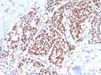 IHC staining of FFPE human parathyroid tissue with TBXT antibody (clone TBXT/7853R). HIER: boil tiss