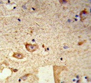 Destrin Antibody / DSTN