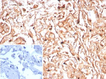 Podoplanin Antibody / gp36