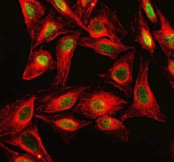 Immunofluorescent staining of DKC1 using anti-DKC1 antibody (green) and anti-Beta Tubulin antibody (