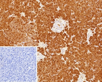 IHC staining of FFPE human pancreas tissue with Colipase antibody (clone CLPS/9900). Inset: PBS used