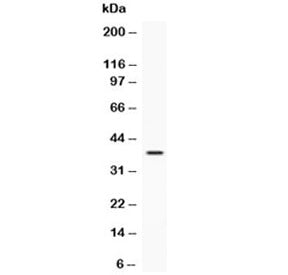 IGFBP3 Antibody