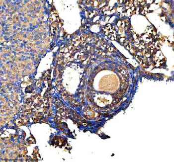 Immunohistochemical staining of GSTM2 using anti-GSTM2 antibody. GSTM2 was detected in a paraffin-em