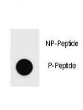 PARP Antibody (phospho-S177)