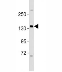 Western blot testing of ERBB4 antibody at 1:2000 dilution + MCF-7 lysate; Predicted molecular weight