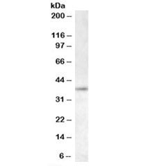 Western blot testing of K562 lysate with RNF2 antibody at 0.5 ug/ml. Predicted molecular weight: ~38