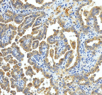 Immunohistochemical staining of xCT/SLC7A11 using anti-SLC7A11 antibody. xCT/SLC7A11 was detected in
