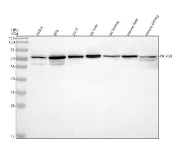 Western blot analysis of DHX58 using anti-DHX58 antibody. Electrophoresis was performed on a 10% SDS