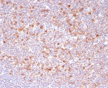 BCMA Antibody / CD269 / TNFRSF17