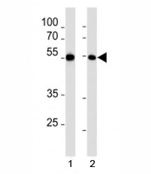 MEF2C Antibody