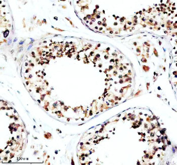 Immunohistochemical staining of TFDP3 using anti-TFDP3 antibody. TFDP3 was detected in a paraffin-em
