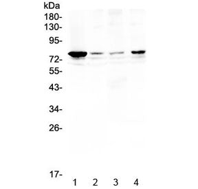 Western blot testing of human 1) HeLa, 2) placenta, 3) MCF7 and 4) SK-OV-3 lysate with RANK antibody