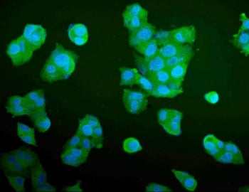 Aldolase A Antibody / ALDOA