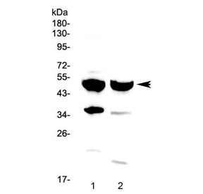 FOXA1 Antibody