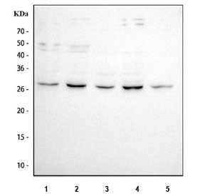 Western blot testing of 1) human MCF7, 2) human PC-3, 3) human HeLa, 4) human SiHa and 5) rat heart tissue lysate with ARC antibody. Predicted molecular weight: 23-29 kDa (multiple isoforms).