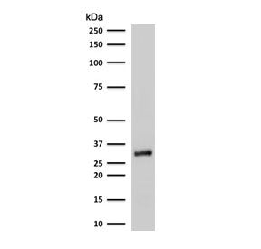 Western blot testing of human A375 cell lysate with RPA32 antibody. Expected molecular weight ~32 kD
