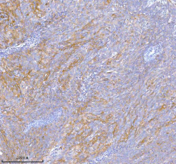 Immunohistochemical staining of TNIK using anti-TNIK antibody. TNIK was detected in a paraffin-embed