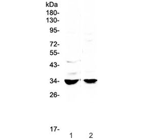 Western blot testing of 1) rat stomach and 2) mouse stomach lysate with ERCC1 antibody at 0.5ug/ml.