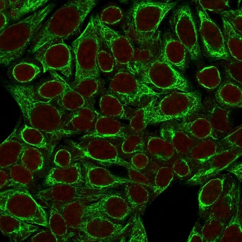 Immunofluorescent staining of fixed human HeLa cells with Cytokeratin 8 antibody (clone SPM192, gree