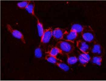 Immunofluorescent staining of FFPE human A431 cells with IKKb antibody (red) and DAPI nuclear stain