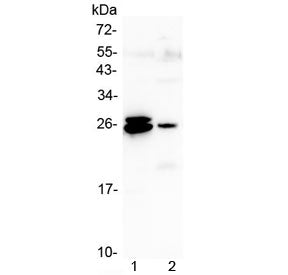GSTA Antibody (alpha 1-5)