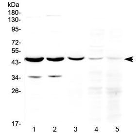Western blot testing of 1) rat brain, 2) mouse brain, 3) human U-87MG (glioma), 4) human Jurkat and