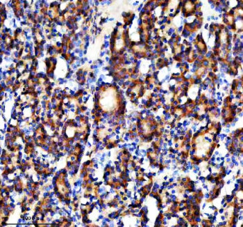 Immunohistochemical staining of NAGK using anti-NAGK antibody. NAGK was detected in a paraffin-embed