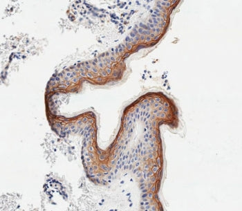 IHC testing of FFPE human skin tissue with Sciellin antibody. HIER: steam section in pH9 EDTA for 20