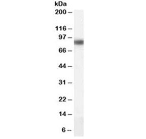Western blot testing of human liver lysate with CPT1A antibody at 0.1ug/ml. Predicted molecular weig