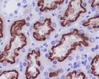 Cubilin Antibody / CUBN