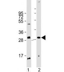 PPP1R3E Antibody