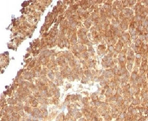 TOP1MT Antibody / Topoisomerase I mitochondrial
