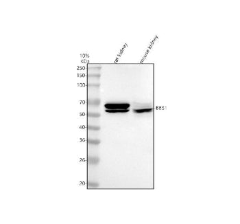 Western blot analysis of BBS1 using anti-BBS1 antibody. Lane 1: rat kidney tissue lysates, Lane 2: m