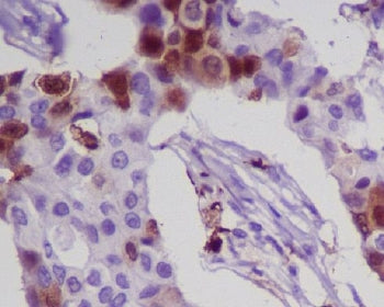 S100A8 Antibody / MRP8 / Calgranulin A / Calprotectin L1L