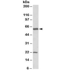 Western blot testing of human frontal cortex lysate with GLAST1 antibody at 0.1ug/ml. Molecular weig