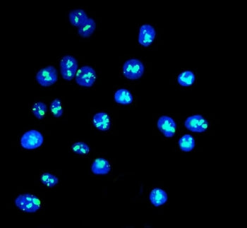 Immunofluorescent staining of FFPE human Caco-2 cells with DDX21 antibody (green) and DAPI nuclear s