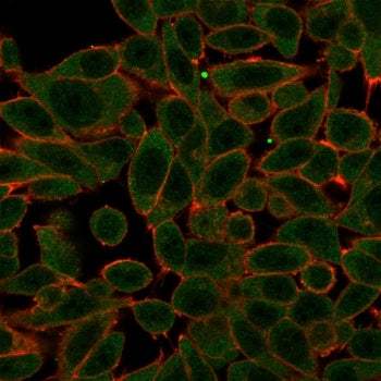 PRDM1 Antibody / BLIMP1