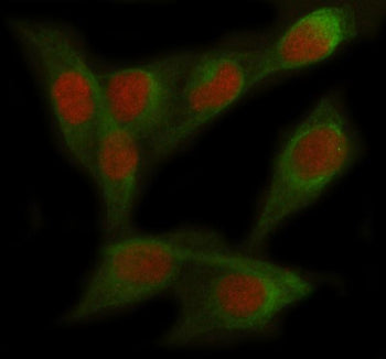 Immunofluorescent staining of FOXC2 using anti-FOXC2 antibody (red) and anti-Tubulin Alpha antibody