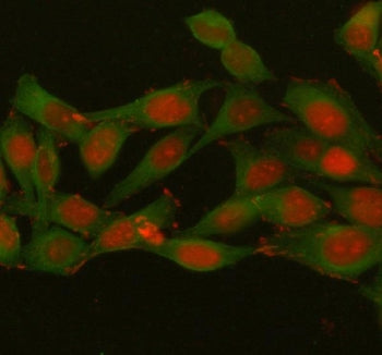 Immunofluorescent staining of FFPE human HeLa cells with Histone H1.10 antibody (red) and Beta Tubul
