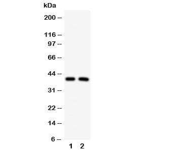 Western blot testing of IRF2 antibody and Lane 1: HeLa; 2: MCF-7 cell lysate. Estimated molecular we