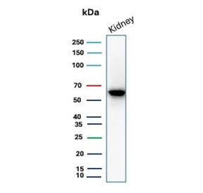 Western blot testing of human kidney tissue lysate with Occludin antibody. Predicted molecular weigh