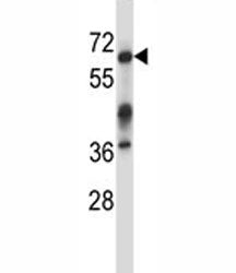 Irak3 antibody western blot analysis in mouse kidney tissue lysate. Predicted molecular weight: ~68k