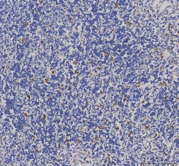 IBA1 Antibody / AIF-1