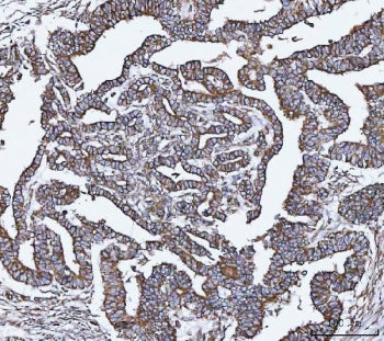 VAPA Antibody / VAP33