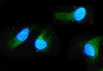 ADO Antibody / 2-Aminoethanethiol dioxygenase