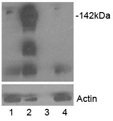 Western blot of HEK293 lysate overexpressing TANK1/Tankyrase (lane 2) and TANK2 (lane 4) tested with