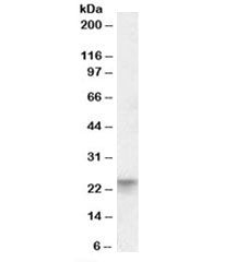 Western blot testing of human colon lysate with TSPAN8 antibody at 0.01ug/ml. Predicted molecular we