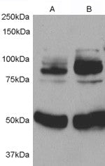 Western blot testing of rat aortic smooth muscle cells before (1) and after (2) infection with human