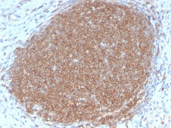 IHC staining of FFPE human lymph node with recombinant CD45RB antibody. HIER: boil tissue sections i
